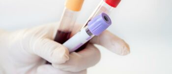 Can You Get Blood Work Done at Urgent Care?