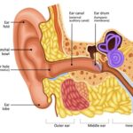 Ear eczema