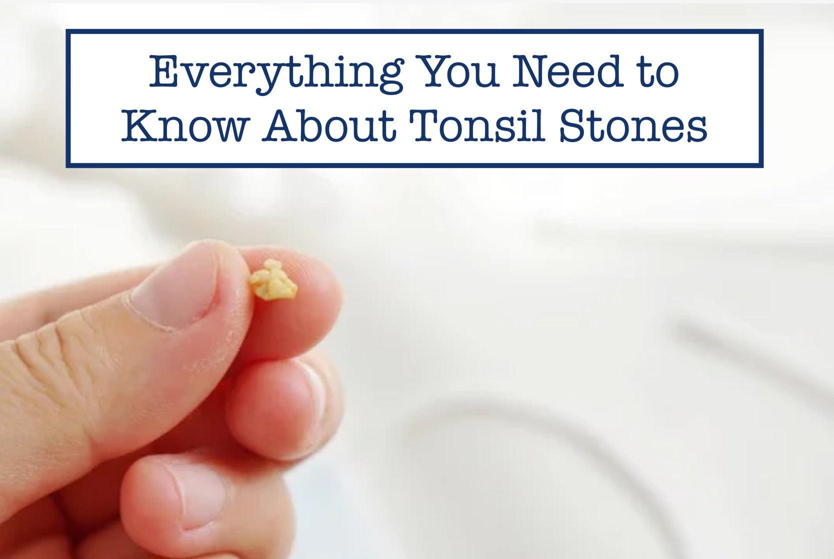 can stress cause tonsil stones