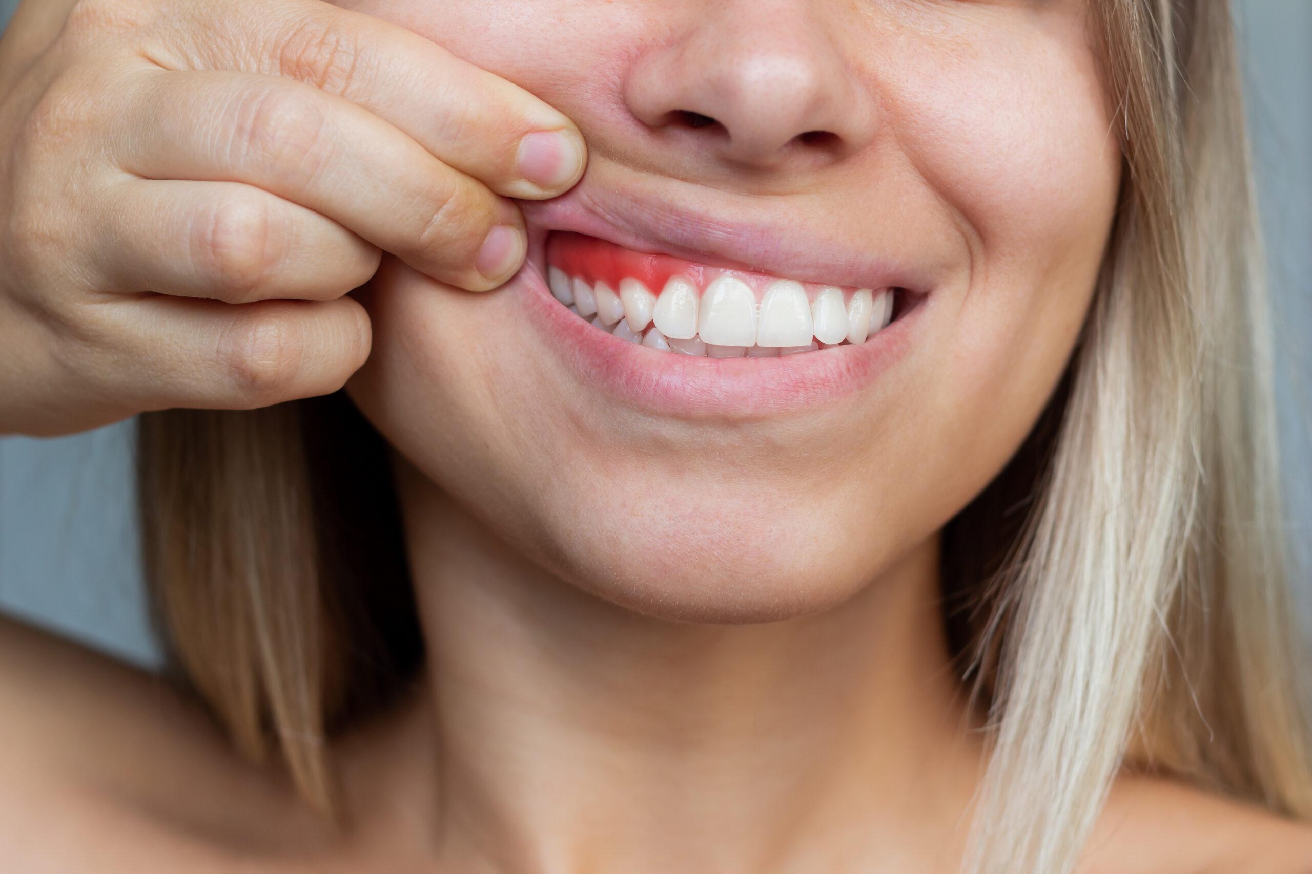 how long does it take for a cut gum to heal