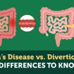 Crohn’s Disease vs. Diverticulitis: 5 Differences To Know