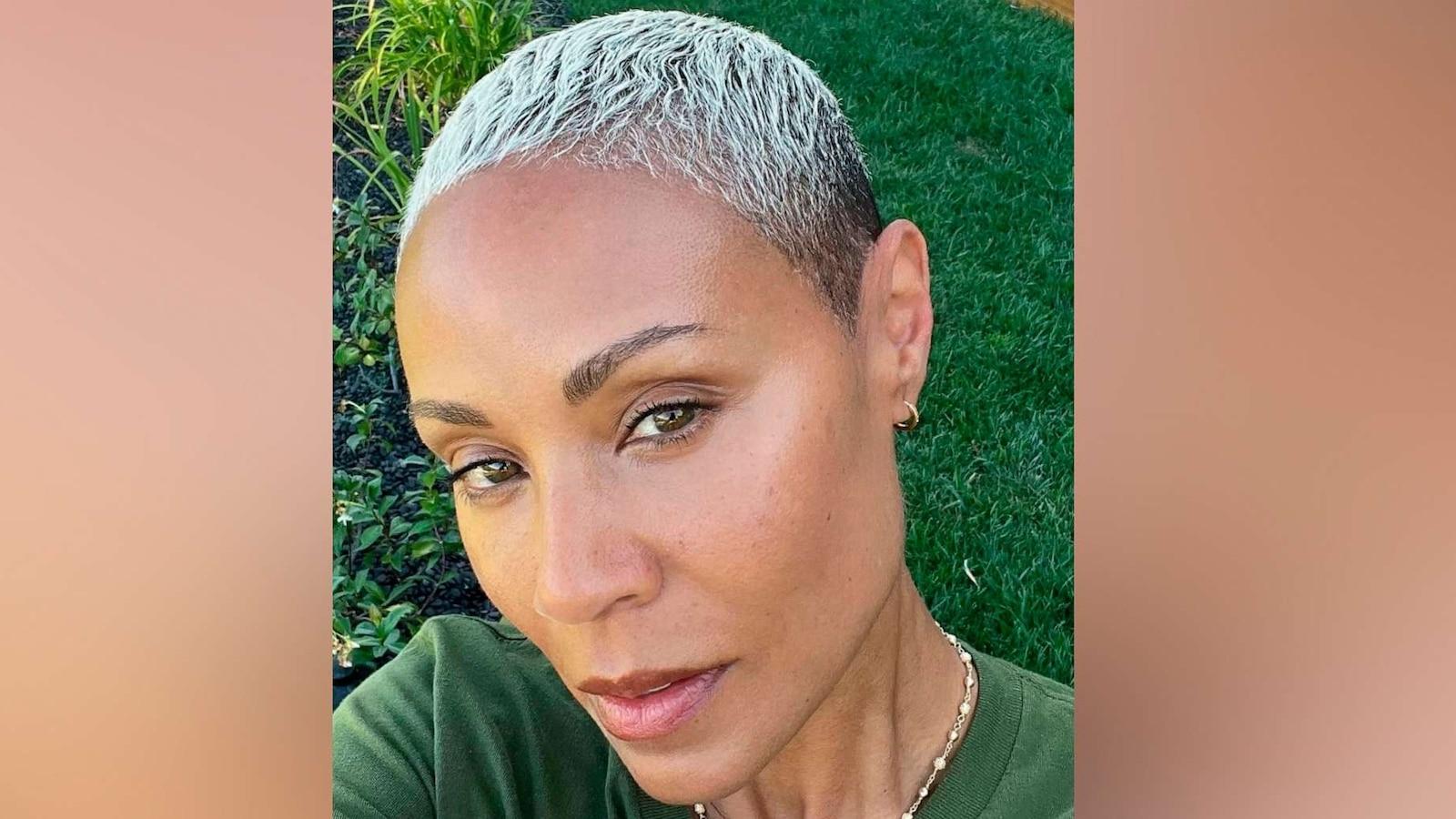 jada pinkett smith alopecia fake