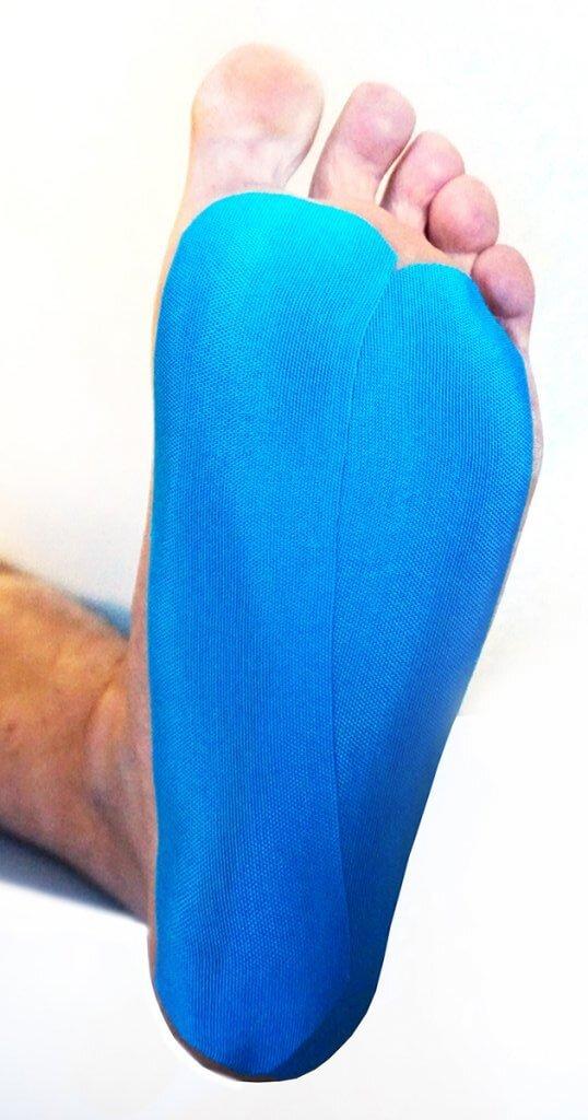 kt tape inner arch pain