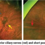 Navigating the Retinal Periphery