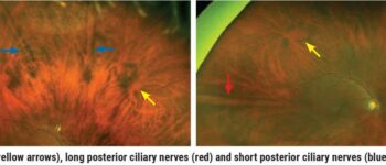 Navigating the Retinal Periphery