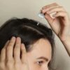 Azelaic Acid for Hair Loss