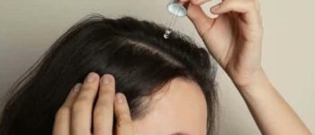 Azelaic Acid for Hair Loss