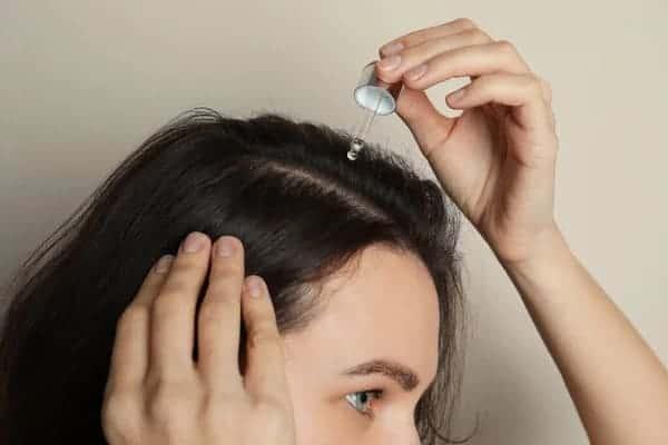 Azelaic Acid for Hair Loss