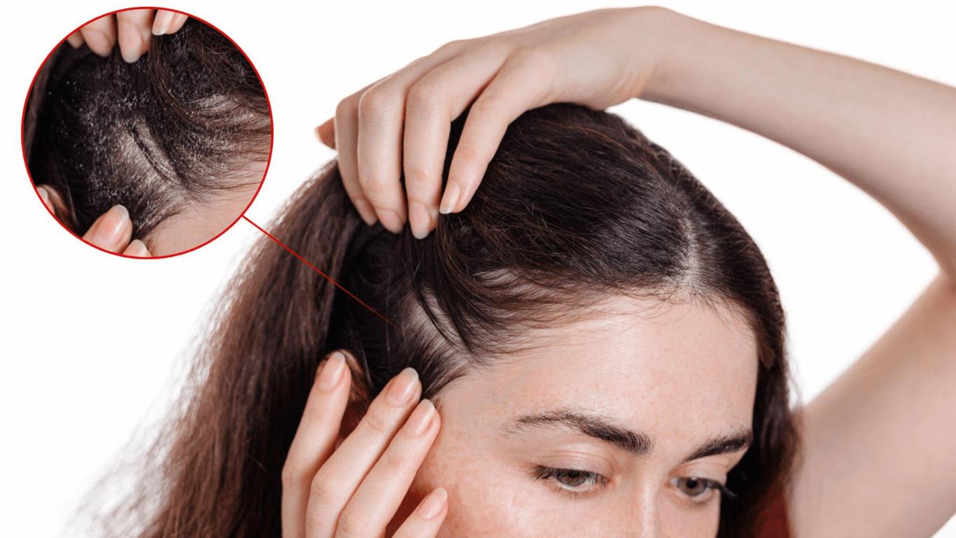 Garnier Hair Loss Lawsuit: The Controversy, Claims, and Resolution