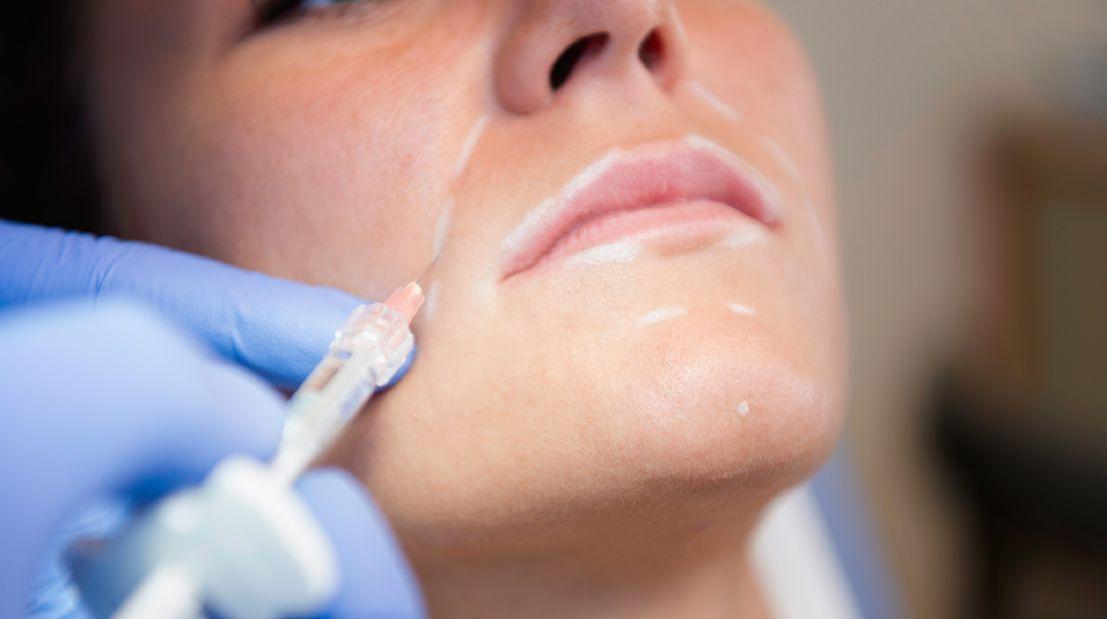 Although hyaluronic acid filler treatments are on the rise, due to medical reasons, they are not suitable for all patients AdobeStock/Microgen