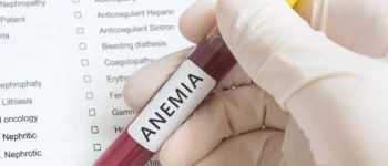 ICD 10 codes for Anemia – Anemia Coding Cheat Sheet