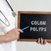 Colon Polyps – Diagnosis and ICD-10 Coding