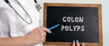 Colon Polyps – Diagnosis and ICD-10 Coding