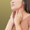 Swollen lymph nodes and other symptoms of lymphoma