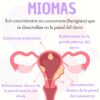 Miomas bajo control: nutrición y ejercicio en acción