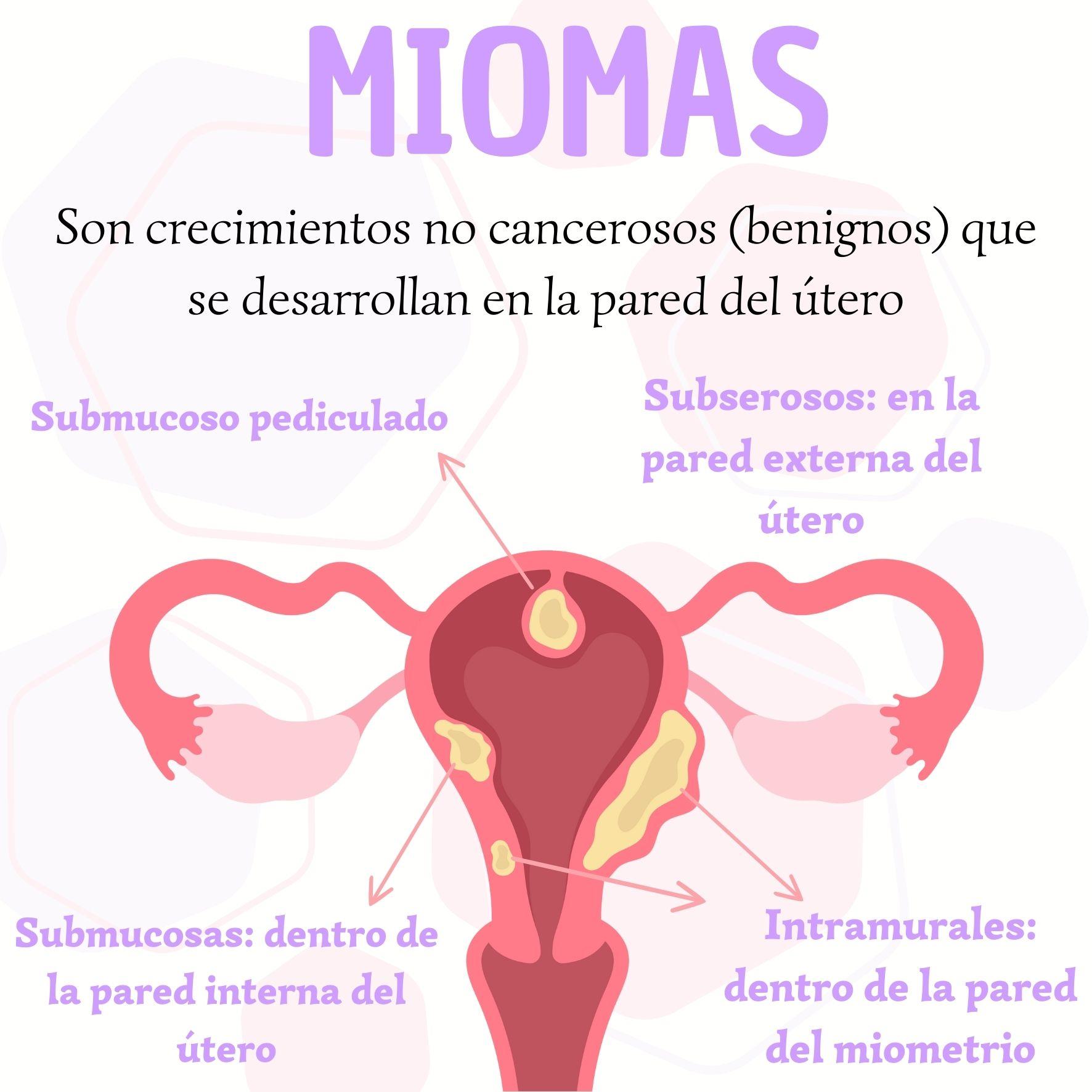 vitamina e para eliminar miomas