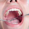 Diabetes, Gum Disease, & Other Dental Problems