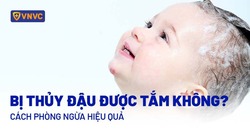 bé bị thủy đậu